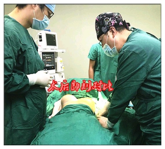 【案例分享-假体隆胸术后恢复按摩手法】