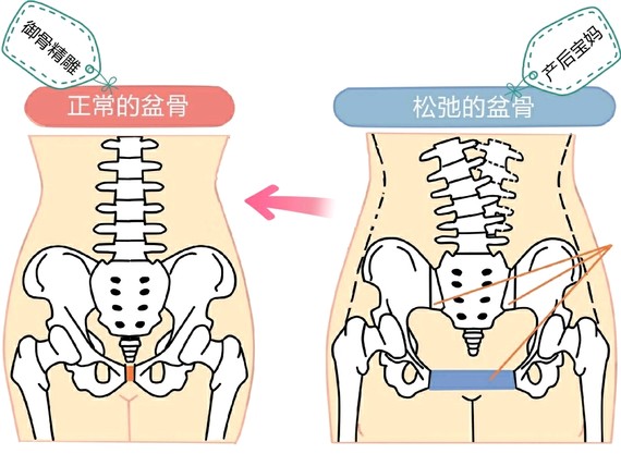 御骨精雕骨盆闭合耻骨闭合①⑧大好处:  ━═━═━◥◤━═━═