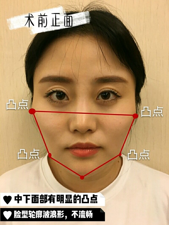 点,同时嘴角两侧也有两个明显比较宽的凸点,整张脸的轮廓像一个葫芦形