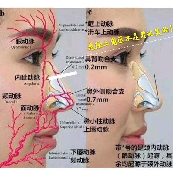 (图3)  鼻部周围血管分布密集,如果经常捏鼻子的话会容易刺激到鼻腔