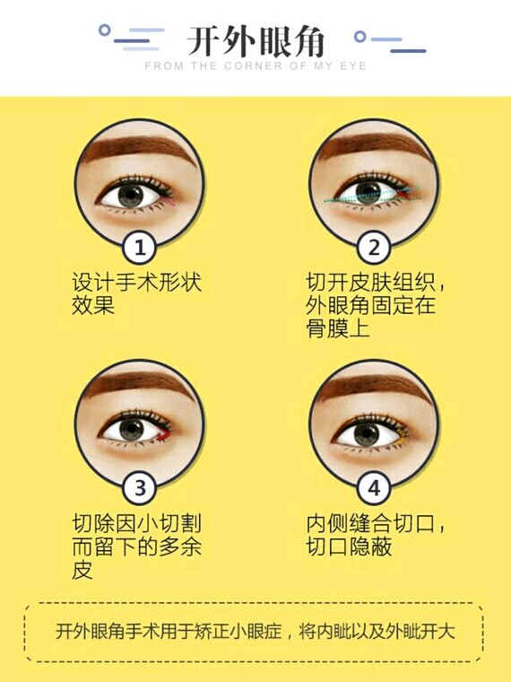 外眼角别轻易开,内眼角看情况做?