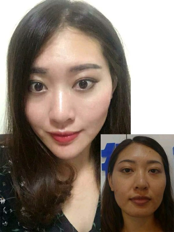 不同原因的"脸大"该怎么瘦脸脸!