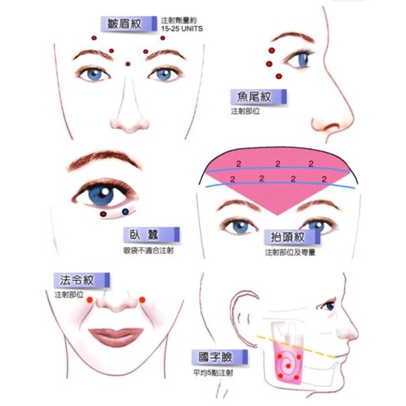 肉毒素除皱,你了解多少71|科普篇78岁月的可怕它