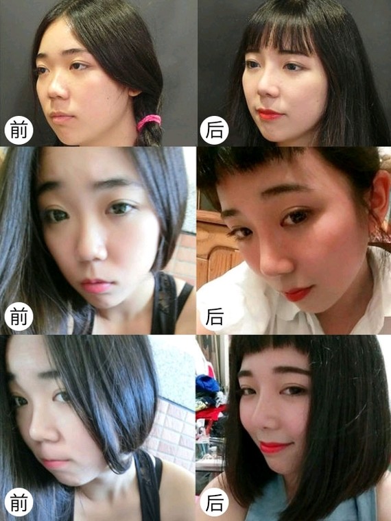 为什么80%的女星隆鼻后都会变猪鼻子,像拿刀切的一样?