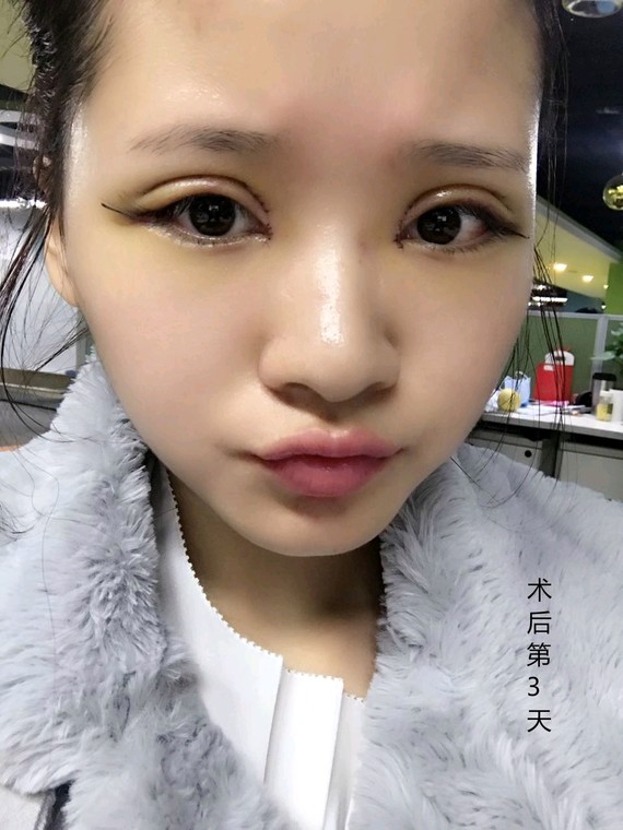 【真人案例】美萌大眼加持,平凡小网红逆袭万人迷