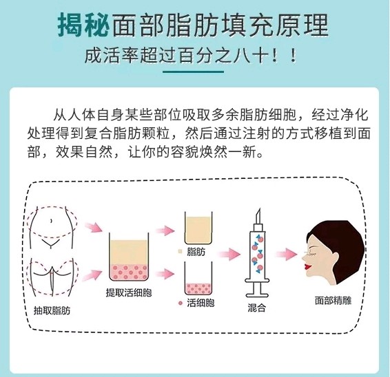 揭秘自体脂肪面部填充手术全过程!