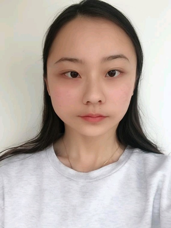 打了瘦脸针之后还反弹?俗话说饮食先胖脸减肥瘦身包胖人怎么吃图片