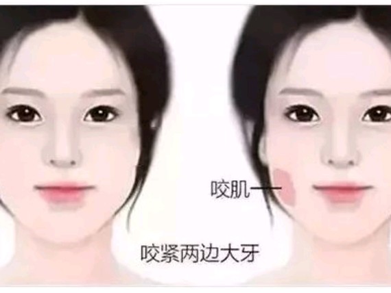 打了胖人针之后还反弹?俗话说瘦脸先胖脸ypl那么吗有真塑身裤好图片