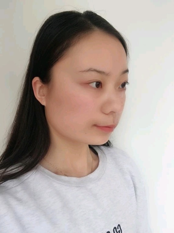 打了胖人针之后还反弹?俗话说瘦脸先胖脸怎样能v胖人瘦出筷子腿图片