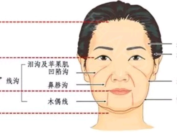 必定是深刻,抢眼的,能让人活生生老10岁那为什么会出现法令纹呢?
