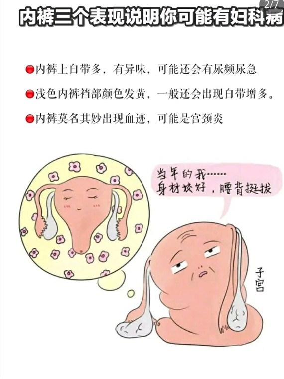 妇科病私处护理 瘙痒有异味经期不调必看