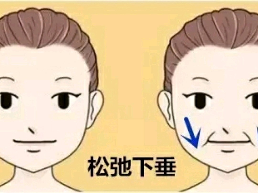 你知道怎么能有效的去除法令纹吗?