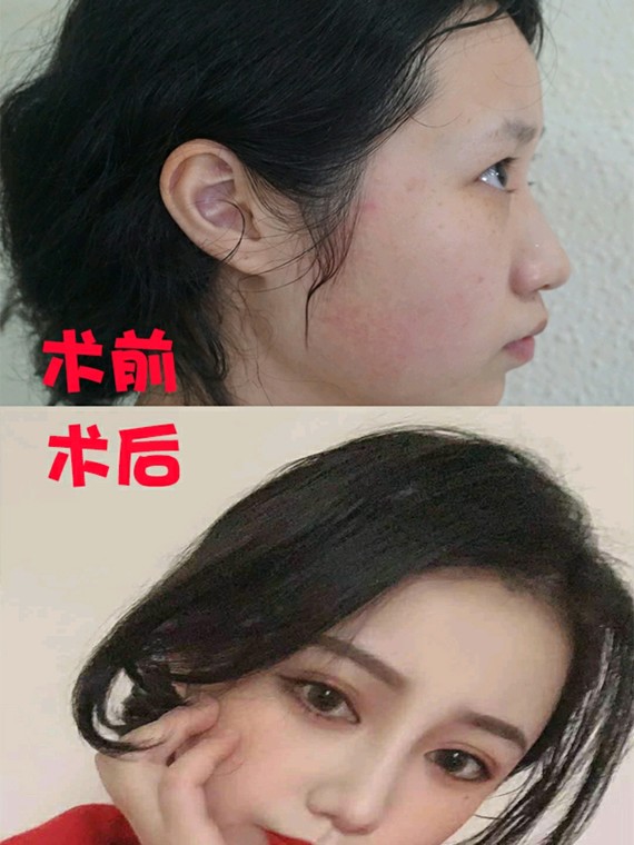 男神眼中最"丑"的女生鼻型蒜头鼻上榜,颜值再高也白_圈子-新氧美容