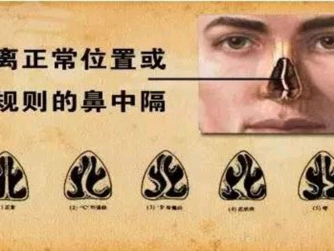 鼻中隔软骨有什么作用?