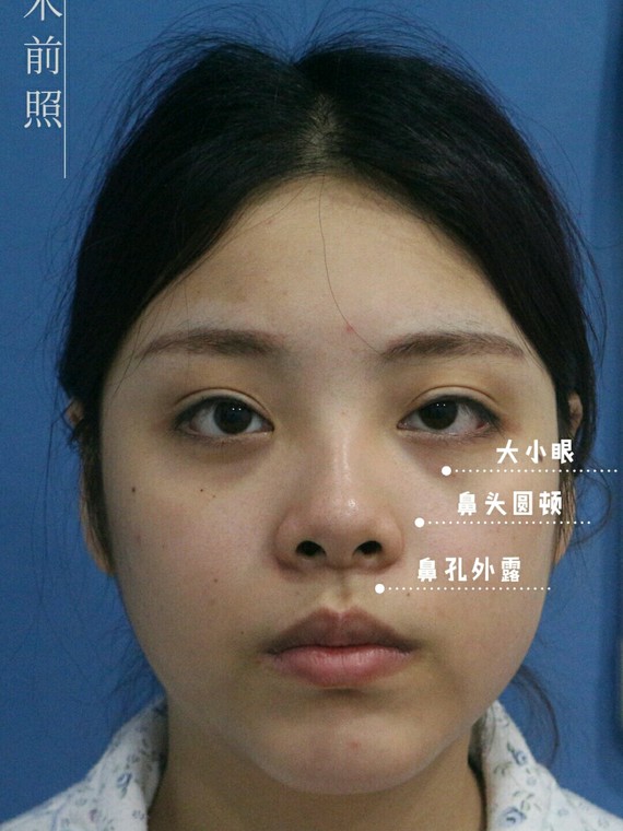 鼻小柱究竟能有多大作用果然,不看不知道