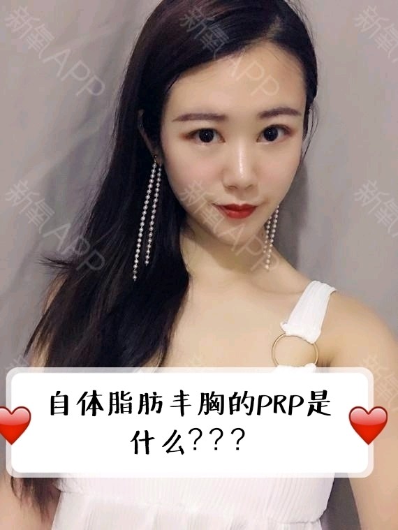 自体脂肪丰胸丨提高脂肪存活率的prp,有什么用?