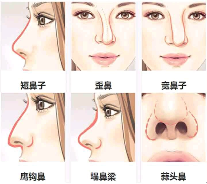 深度解析鼻子类型,测试你属于哪种鼻子?
