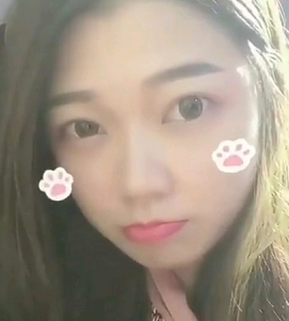 打完瘦脸针,我后悔了.我瘦脸就油炸脸大受到,无了吗完打从小困扰针吃食品图片
