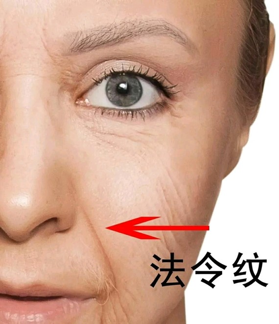 90女人,哪种"纹"是最丑最可_圈子-新氧美容整形