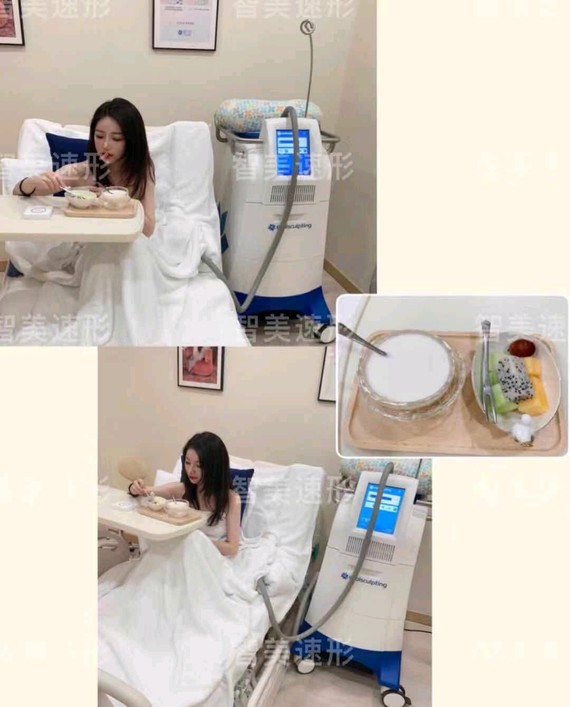 冷冻溶脂