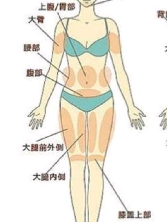 吸脂瘦背部