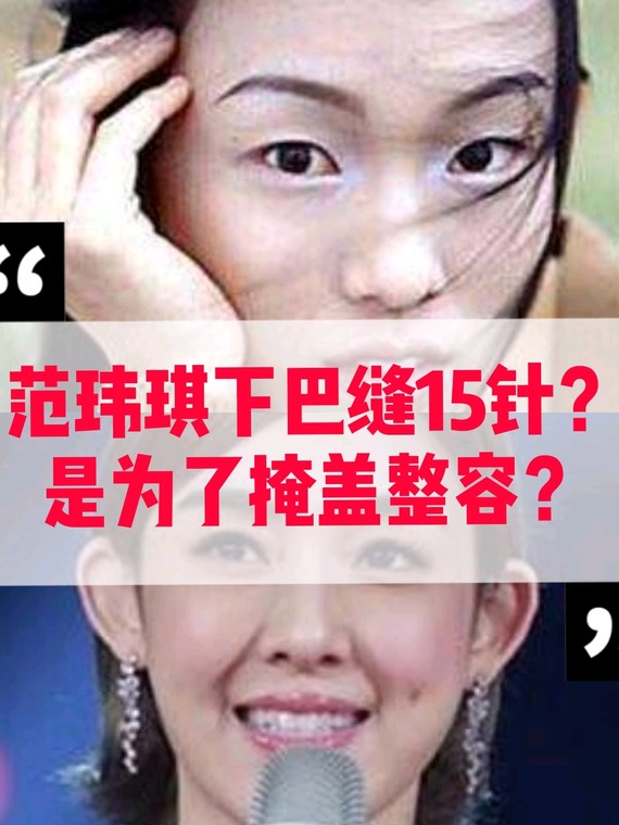 明星八卦