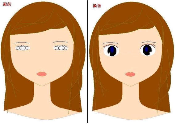 双眼皮
