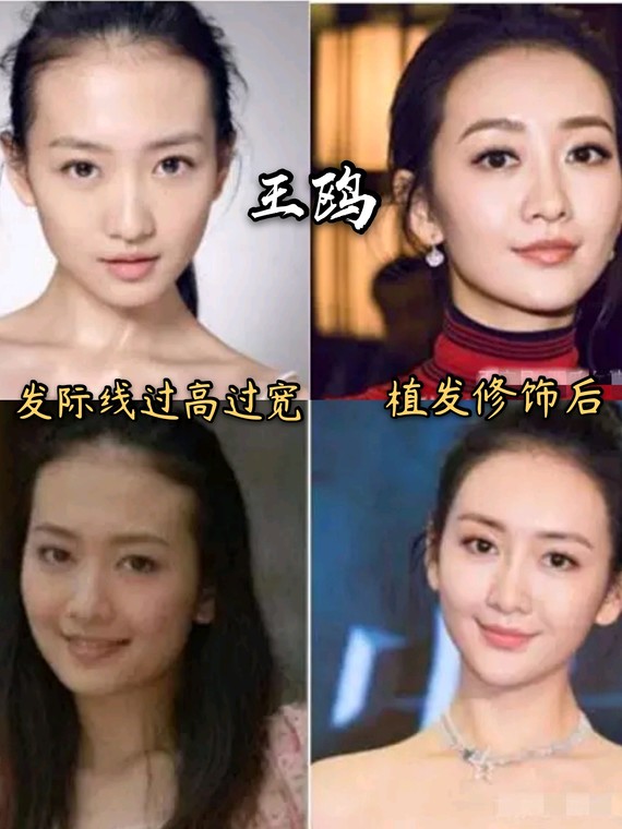 (发际线成就女神)
