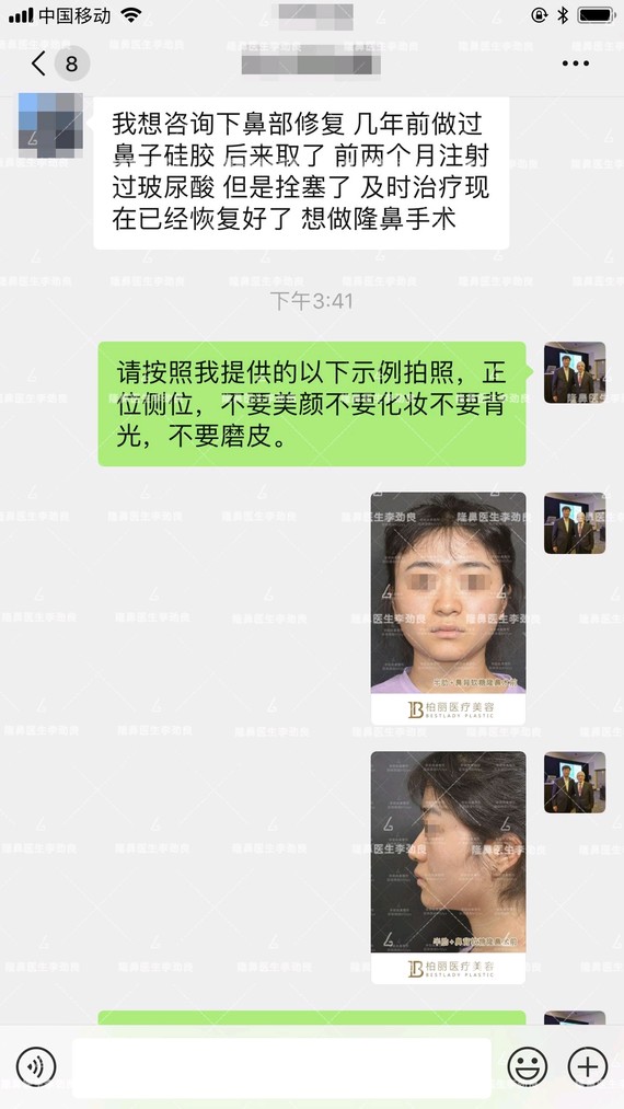 玻尿酸注射隆鼻一直不是我所推荐的.