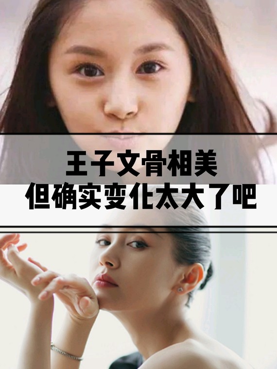 王子文,典型的v脸,但比之尖尖的v脸,眼睛鼻子都有很多锐角,又因为