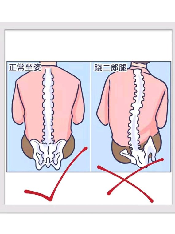 跷二郎腿的危害