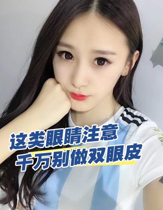 这类眼睛注意千万别做双眼皮爱美是女人的天性,大眼睛_圈子-新氧美容