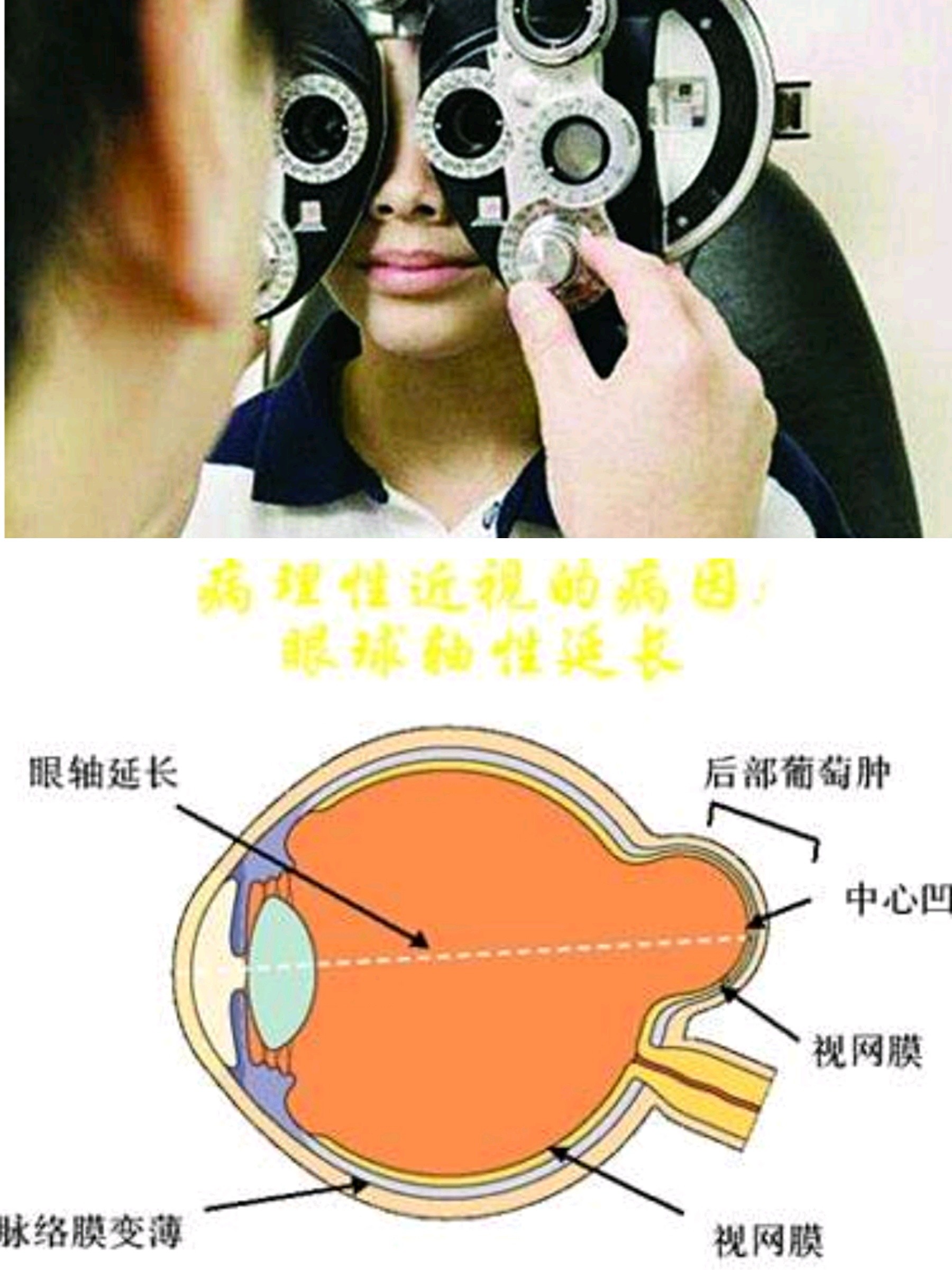 让人眼瞎的护眼法