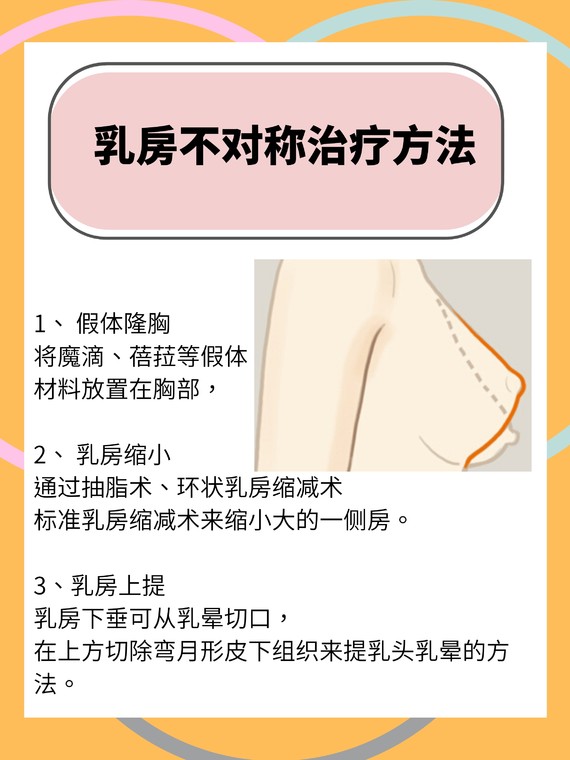 乳房不对称是乳房疾病的早起征象?