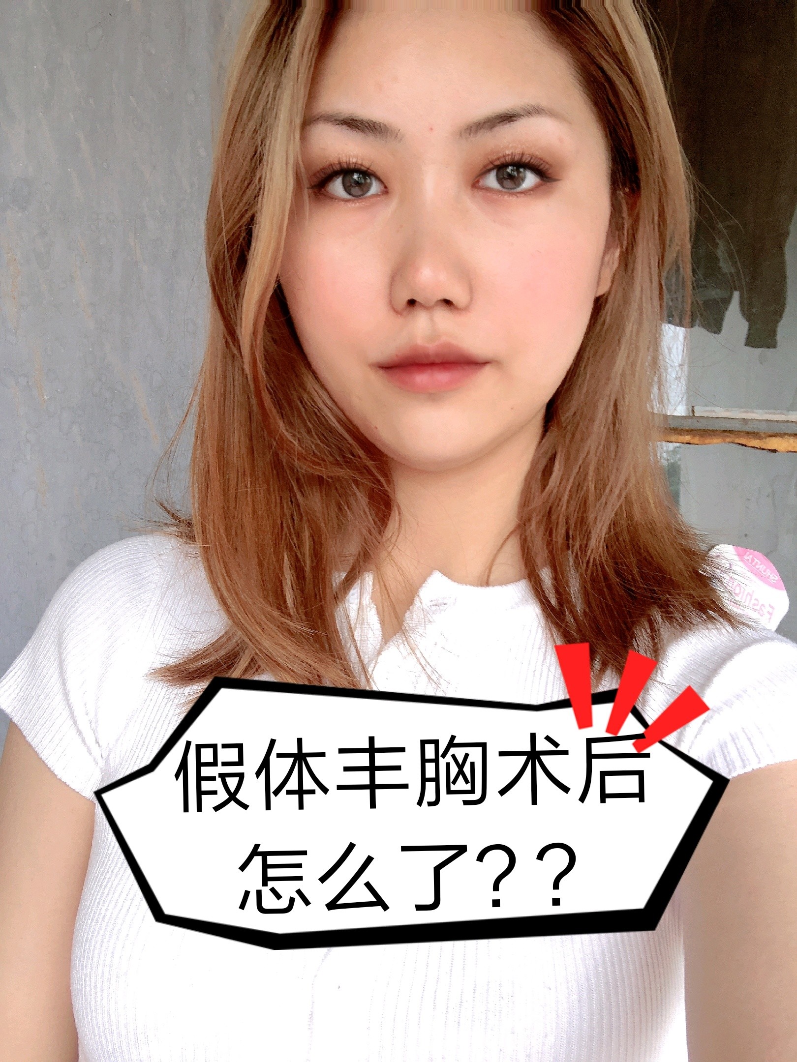 体质很瘦,做完假体丰胸后手感很硬是怎么回事?