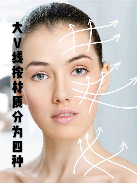 大v线按材质分为四种9191线雕采用的线都是子蛋白