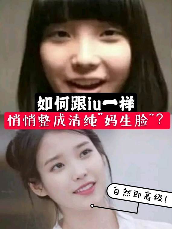 如何跟iu一样,悄悄整成清纯妈生脸?iu为什么是美_圈子-新氧美容整形