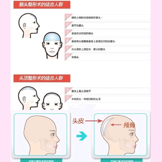 【头包脸到底有多重要】