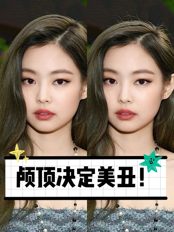 jennie的颅顶高度太鲨我了·最近在研究颅顶高_圈子-新氧美容整形