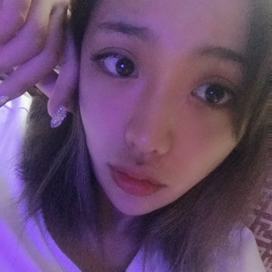 没化妆,大家将就着看吧,现在是拆线后的第三天,在这