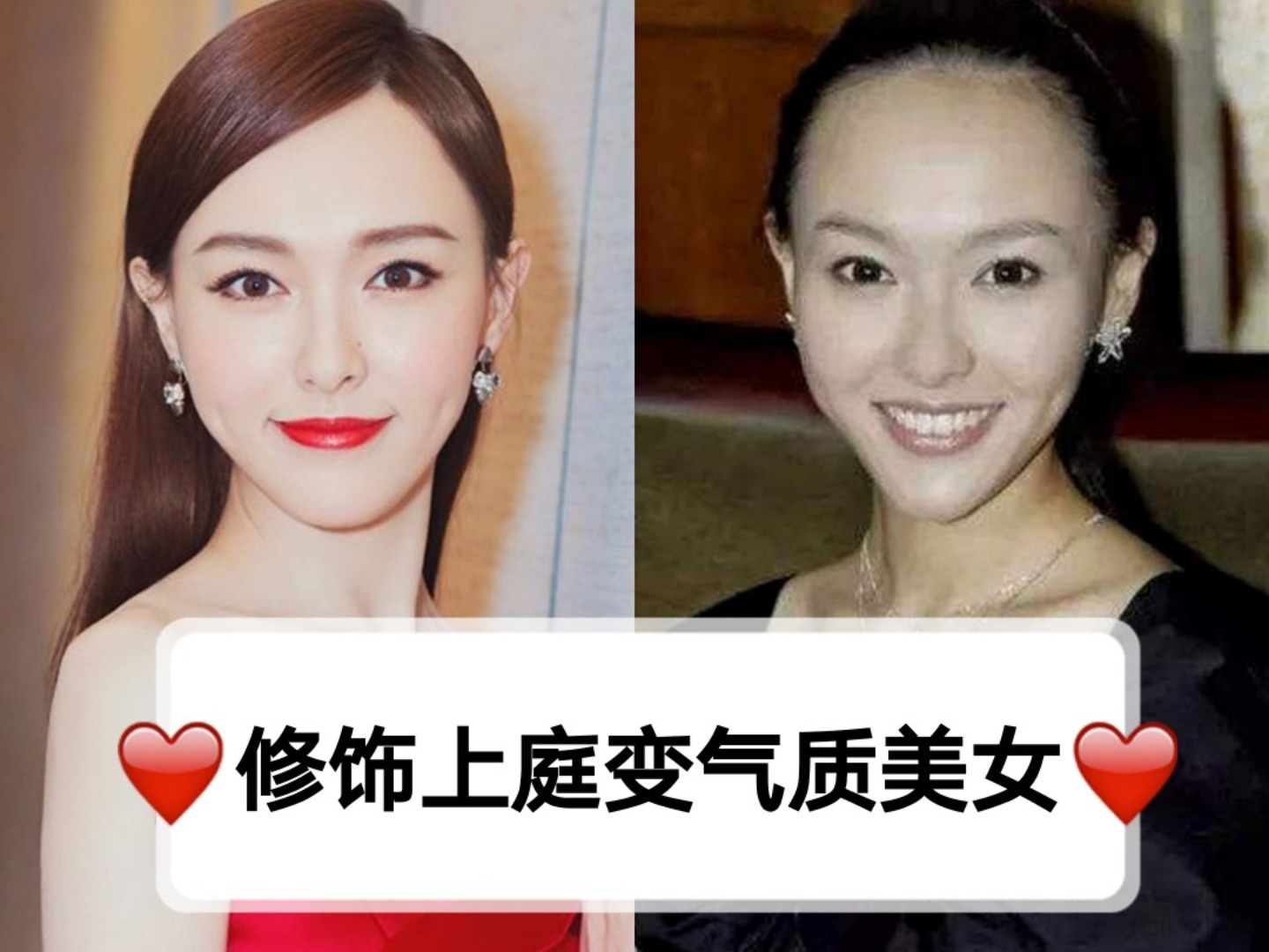 俗话说"天庭饱满,地阁方圆,那么天庭指的就是上额_圈子-新氧美容整形