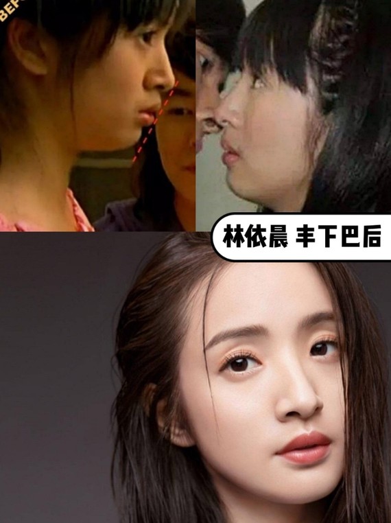 摆脱土气的教科书之一,推荐大家康康十元和林依晨~ 林依晨在年轻时