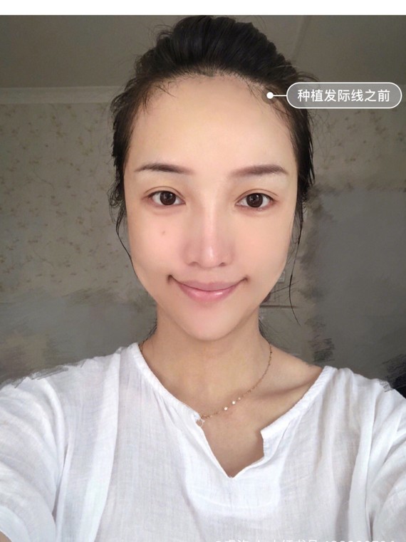 我是额头高的一个女生,关于
