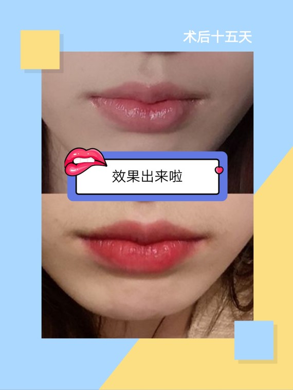 千万不要做花瓣唇,否则你会爱上的