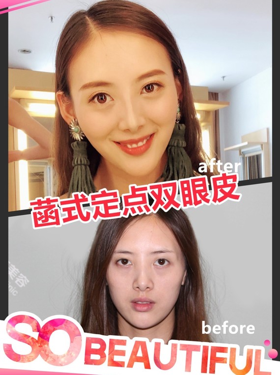 菡式定点双眼真人案例