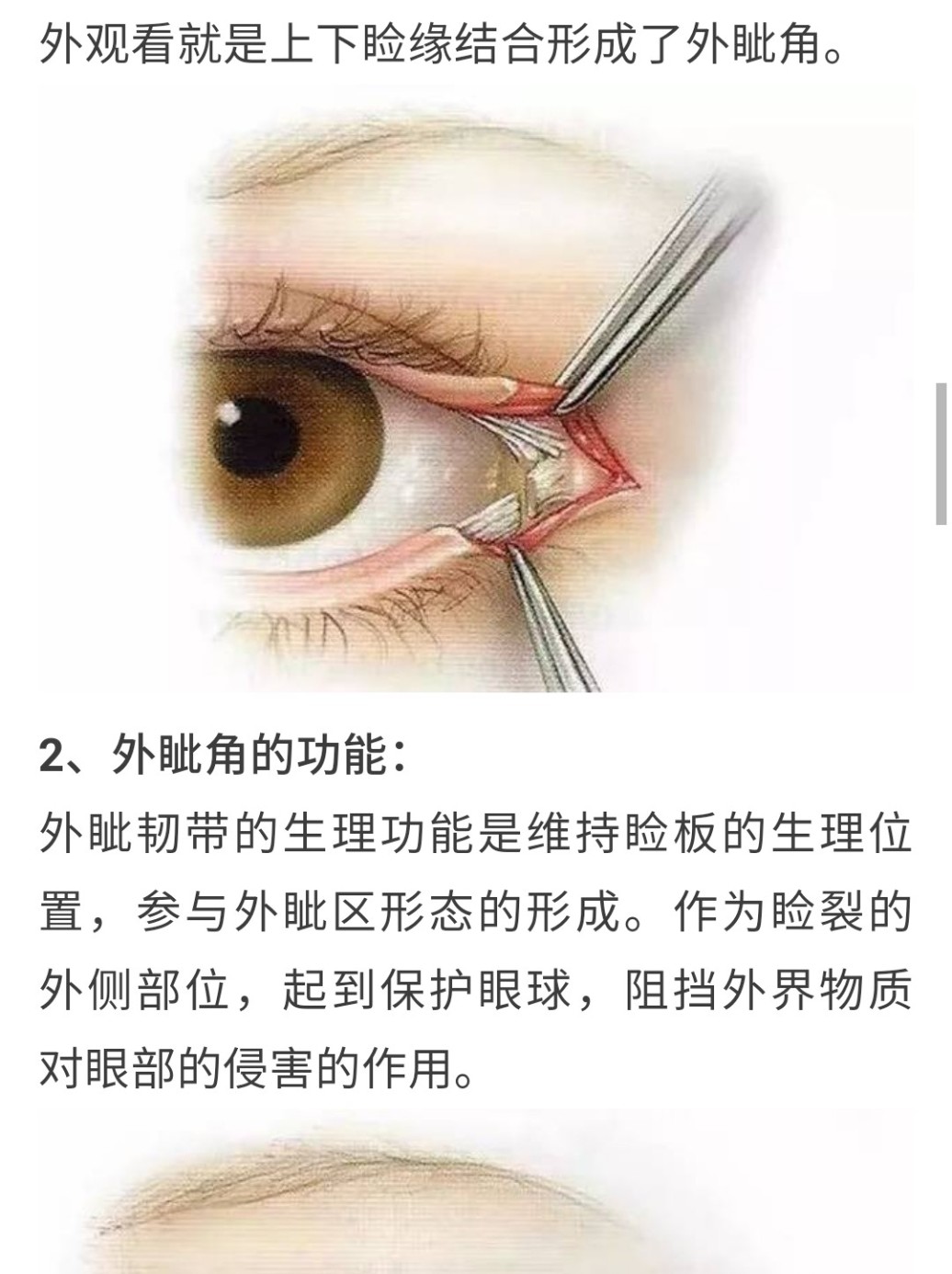 18天,我百度了一下,我这个情况是外眦韧带断裂,这