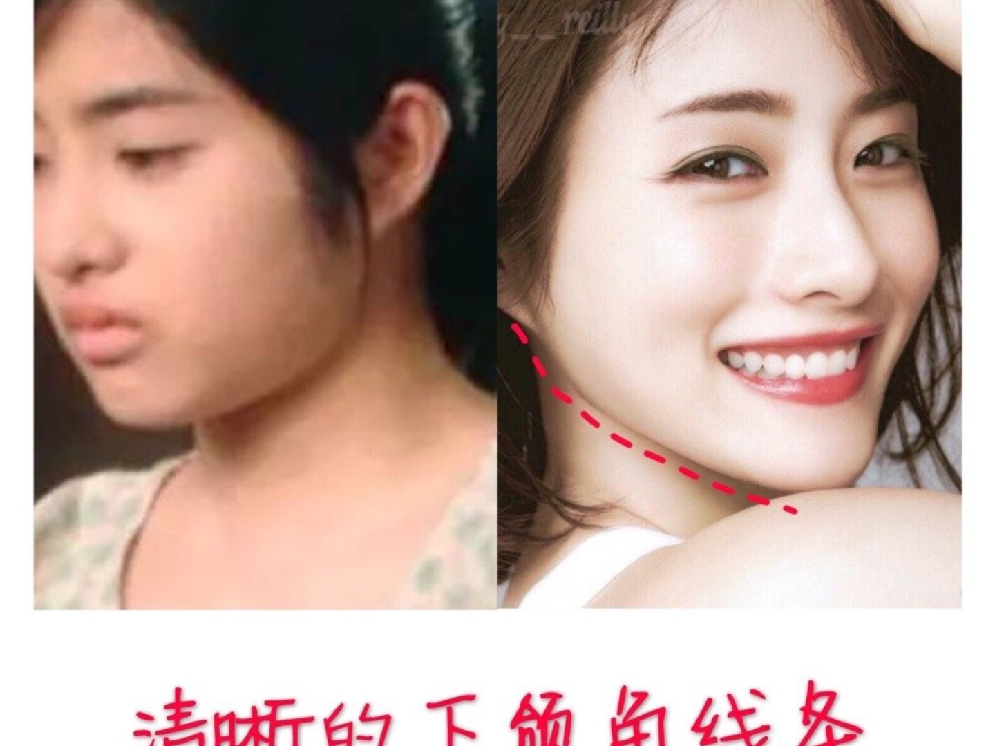 这三个部位,直接影响了侧脸的好看程度