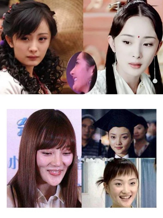 杨幂郑爽↓92杨幂:削下颌骨_圈子-新氧美容整形