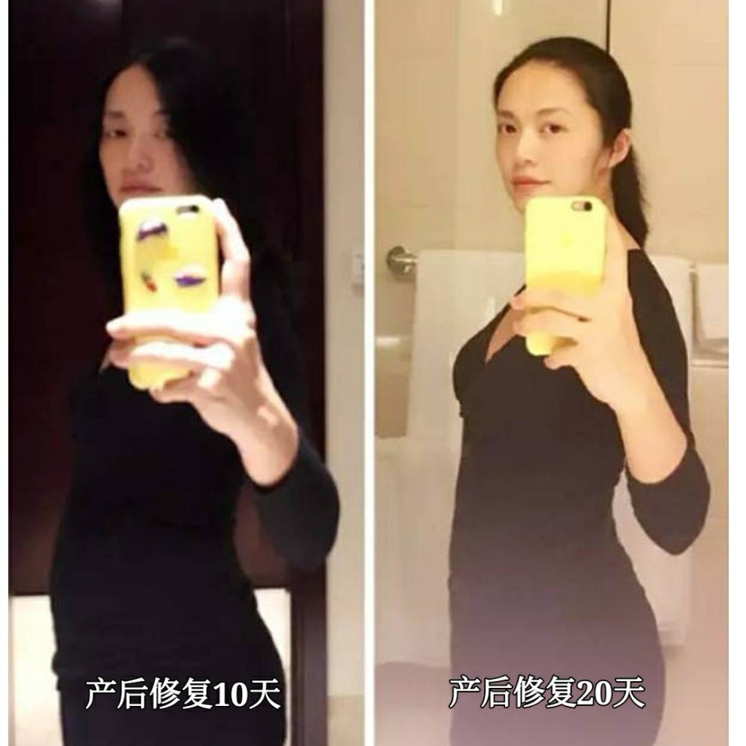 明星产后光速恢复,背后到底有什么秘密?是时候揭开真相了.