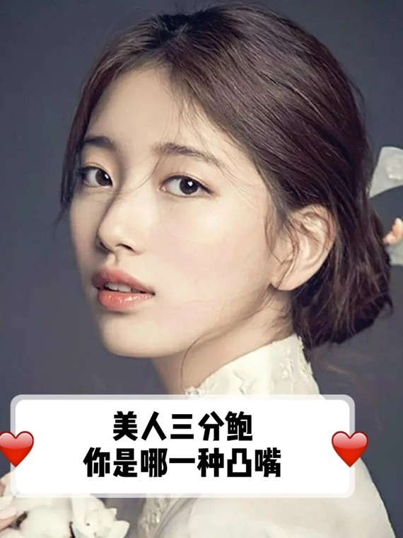 都说美人三分龅,同样是凸嘴,凸嘴也有不同种类,我们_圈子-新氧美容